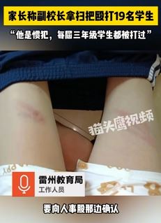 家长曝雷州塘北小学副校长暴力体罚学生
