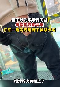 男子裤子被烧大洞冒烟还以眼睛出了问题