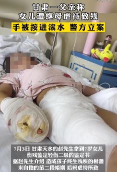 甘肃一父亲称女儿遭继母虐待致残 手段残忍的令人发指