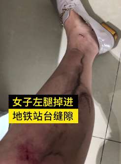 深圳一女子腿卡地铁与站台缝隙 危急关头保安拼命把腿拉出