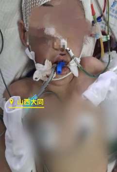 12岁女孩被继母虐打成植物人