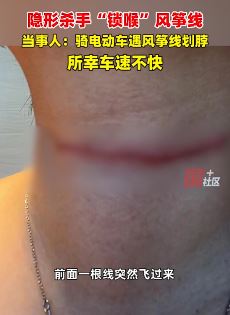 福建宁德一女子骑车被风筝线划破脖子