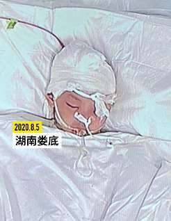 女童遭邻居砸伤轻松筹上筹款百万 家长称款项难提现