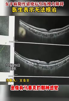 北京一女子发烧致眼睛黄斑水肿，看东西像打了马赛克