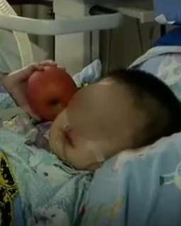 医院温度计坏了致男童住院20天