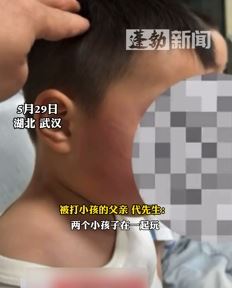 男子曝儿子与同伴争抢玩具起冲突遭对方家长扇脸