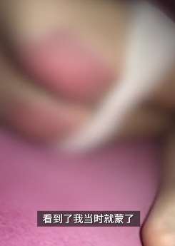 重庆一6岁女孩未完成作业被老师打伤