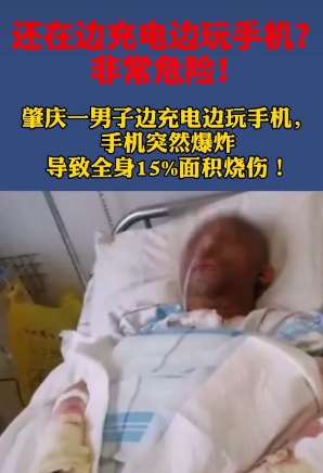 男子边充电边玩手机爆炸 全身15%面积烧伤