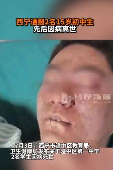 西宁通报2名15岁初中生先后因病离世