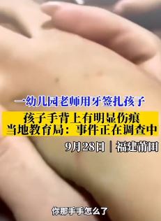 福建莆田一幼儿园老师用牙签扎孩子