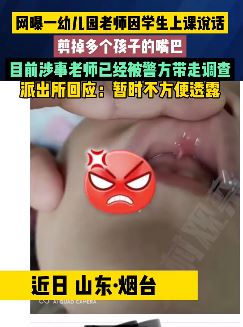 烟台一幼儿园老师用剪刀剪孩子嘴巴