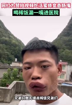 网红博主为流量生吃活蜜蜂 下一秒悲催了！