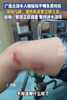 广西北海多名游客被不明生物咬伤