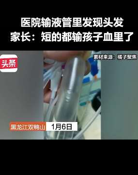 双鸭山一医院输液管里发现头发
