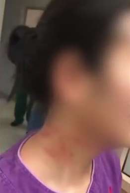 广州一外籍新冠患者打伤护士事件警方已立案调查