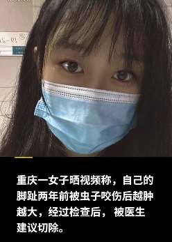重庆一女子小脚趾被虫叮咬没在意 2年后越肿越大被迫切除