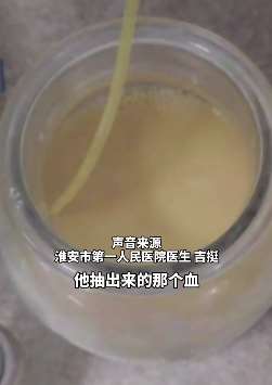 男子长期吃烧烤血液变成牛奶色，医生：死亡率高达50%