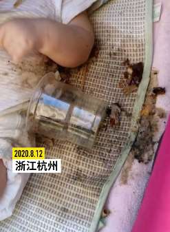 杭州一小区高层掉下只烟灰杯砸伤3个月婴儿