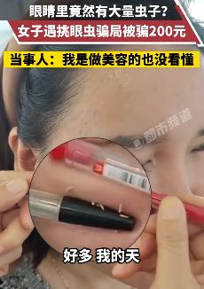 青岛一女子遇挑眼虫骗局被骗200元 网上一查是皮脂腺