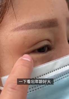 西安一女子割双眼皮失败，24岁看起来像个大妈