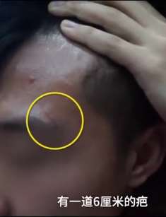 因奖学金被打住院学生发表回应