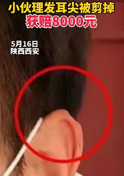 西安一小伙理发时耳尖小块肉被剪掉