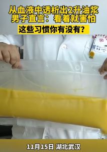 男子血液中透析出2升油浆 看着都瘆人！