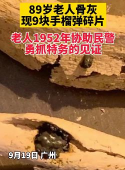 89岁老人骨灰里现9块手榴弹碎片
