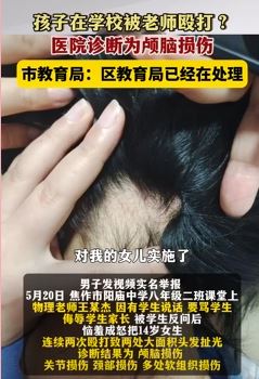 河南焦作一家长曝孩子在学校被老师殴打
