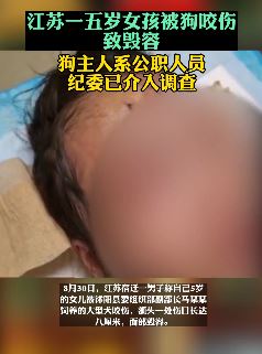 江苏一五岁女孩被狗咬伤致毁容 狗主人系公职人员