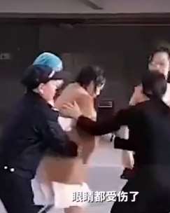 医院确认女生被泼的是硫酸，严重或毁容留疤