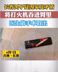 长春一男子疑因家庭矛盾吞打火机