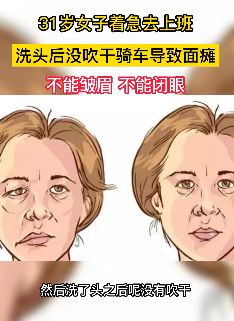 女子着急去上班洗头后没吹干骑车致面瘫