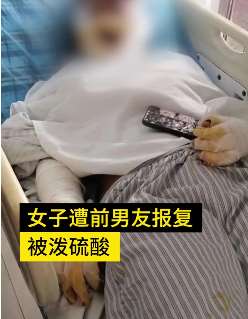 广东一女子被前男友泼硫酸 称得不到就毁掉！