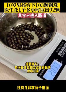 南通一10岁男孩吞下103颗钢珠