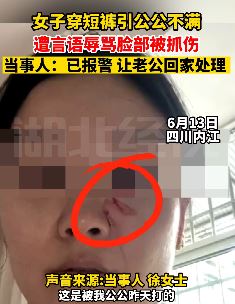 女子穿短裤引公公不满遭辱骂殴打