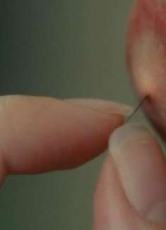 女孩脸上冒出一个痘，轻轻用手一挤，竟挤出无数小蜘蛛