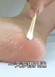 万万没想到脚部干裂最怕它，只需一个土方法，看学会受用一辈子