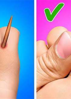 几个超级实用生活小技巧，一般人都不知道，学到就是赚到！