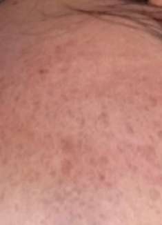 天气热皮肤干燥，分享个避免皮肤干燥的好方法，补充皮肤水分