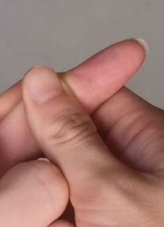 手上扎了刺儿不要用针挑，教你1招让刺自己跑出来，简单很实用