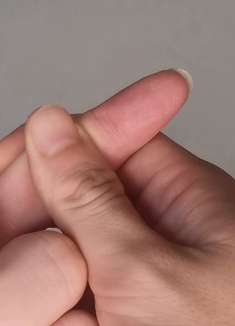 手上扎了刺儿不要用针挑，教你1招让刺自己跑出来，非常简单实用