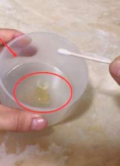 红霉素软膏加它一起用,解决了很多爱美的女性烦恼,效果真不错