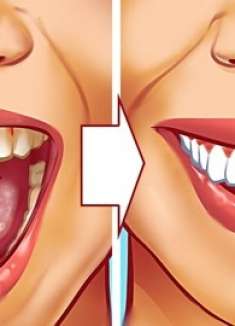 10种祛除牙垢的方法，赶紧学起来！