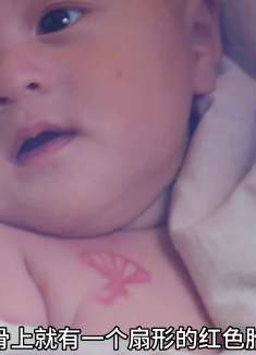 第1集 | 小女孩锁骨上有个扇形胎记，竟改变了她的一生
