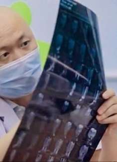 10个月小孩只有8公斤,肿瘤占据体重四分之一