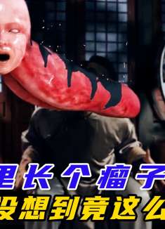 小伙嘴里长了个瘤子，竟然惊动了一大批的道士