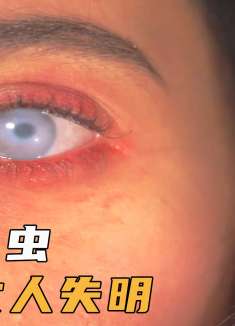 女人睁开眼，发现自己失明，消防队在眼睛里找出小蠕虫，惊悚美剧