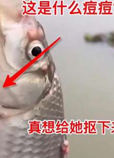 这是什么痘痘？真想给她抠下来