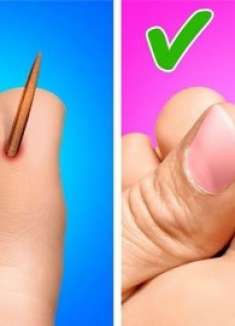 头疼撞伤如何快速缓解，你一定都要掌握哦！